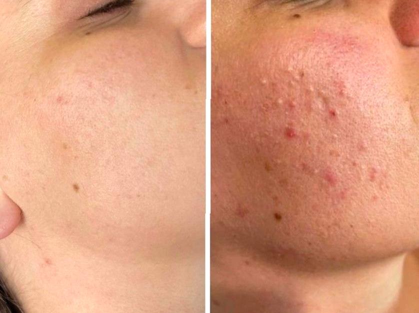 Tips for Maintaining Skin Health While Wearing Makeup