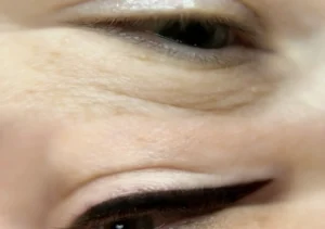 Can you drive home after eyeliner tattoo?