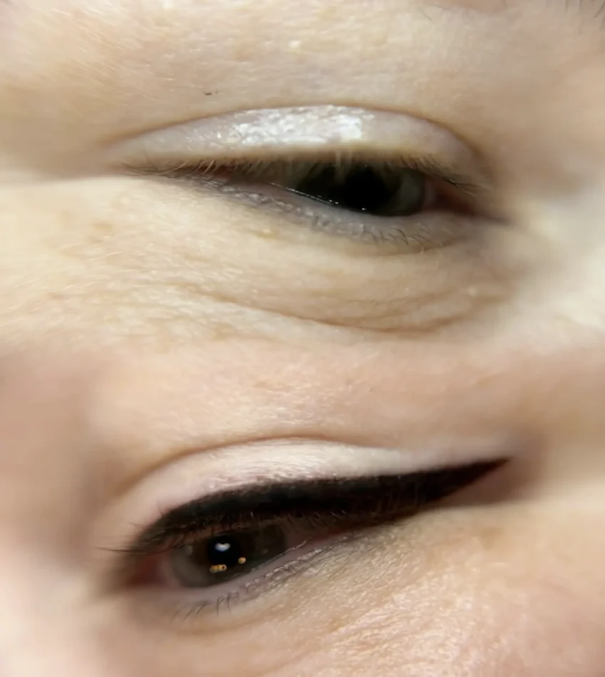 Can you drive home after eyeliner tattoo?