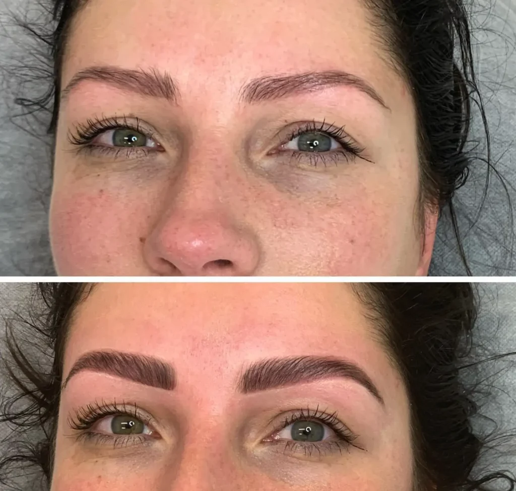 cosmetic tattoo Melbourne