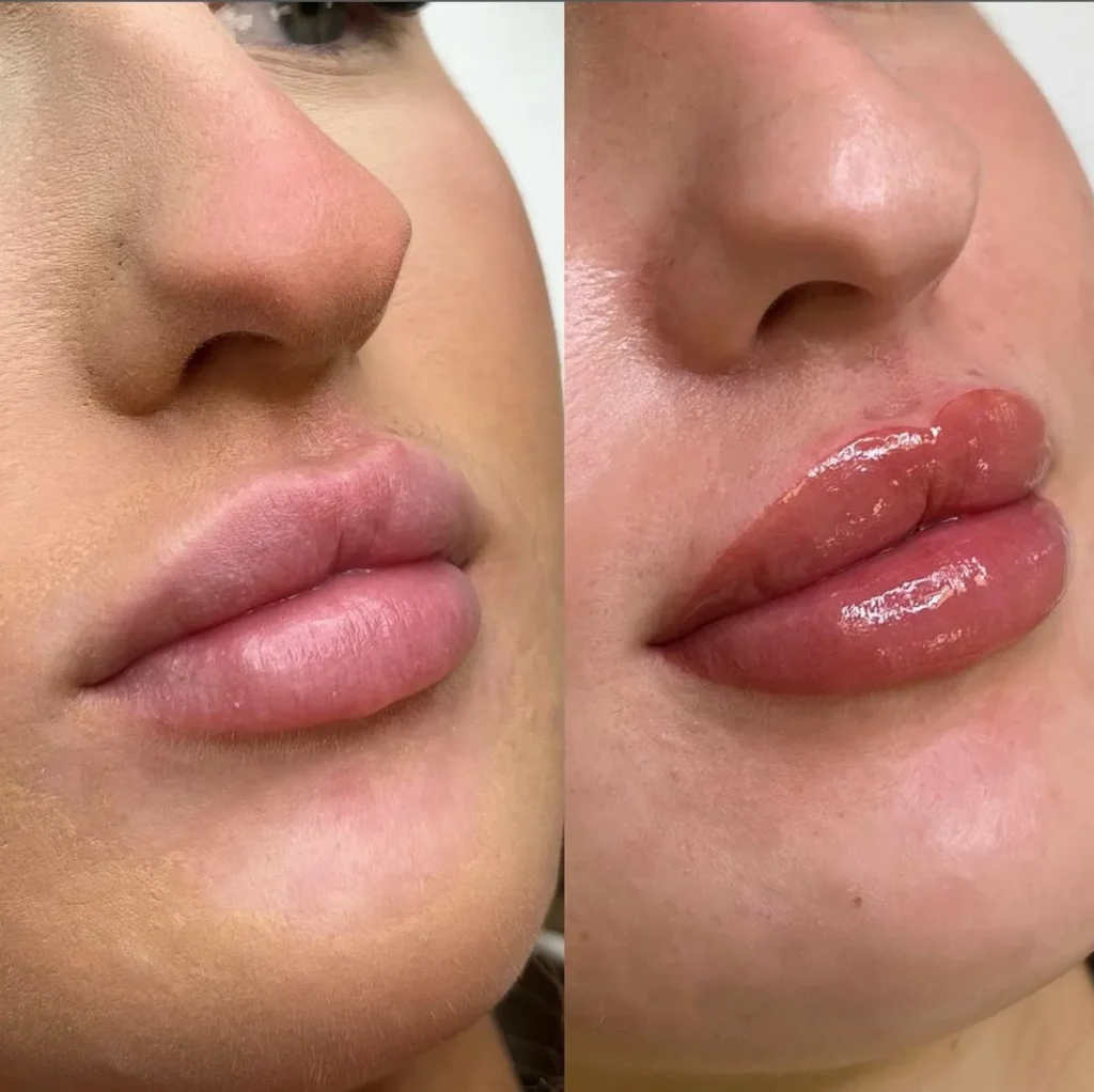 lip tattoo in Melbourne