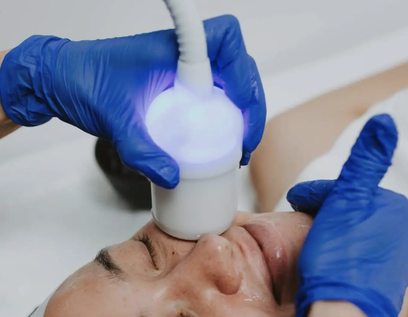 cryoskin training